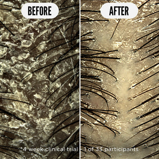 Care Taker Scalp Tonic - 75ml